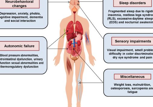 NON MOTOR 1 non motor
